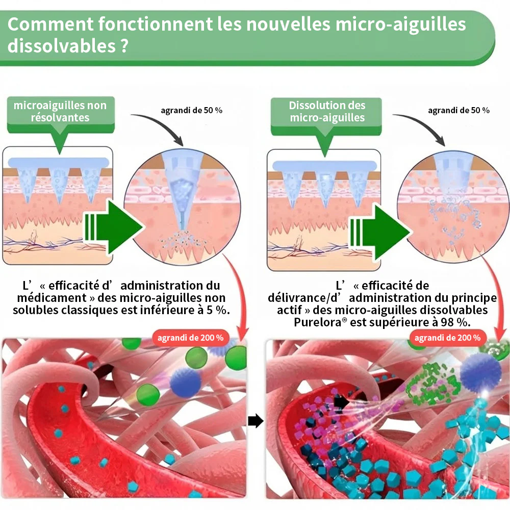 🔥 Nouveauté & Meilleure vente丨Purelora® Moringa Berbérine x NAD+ Patch Nano-Microneedle 10-en-1 Une application par jour, changements visibles dès 7 jours. Pour accompagner la gestion du poids et le bien-être global. - Image 5